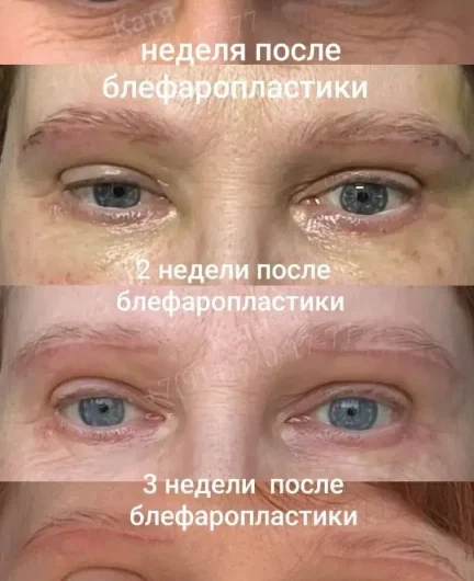 0a61f32e-ab78-476f-8bdc-74707a3284aa-i-2026-10-08t110739.044.webp